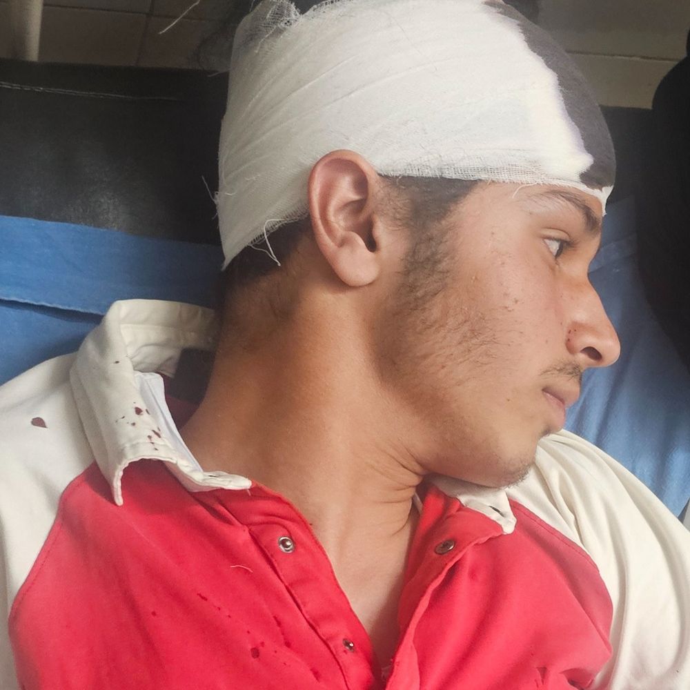 मोहाली में किशोर पर जानलेवा हमला:  धारदार हथियार से किए वार, स्थानीय लोगों ने पहुंचाया अस्पताल, पांच पर आरोप – Mohali News