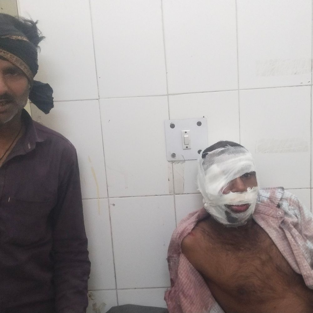 बाइक फिसलने से मामा की मौत, दो भांजे घायल:ललितपुर में रेलवे स्टेशन से बहन को लेने आया था