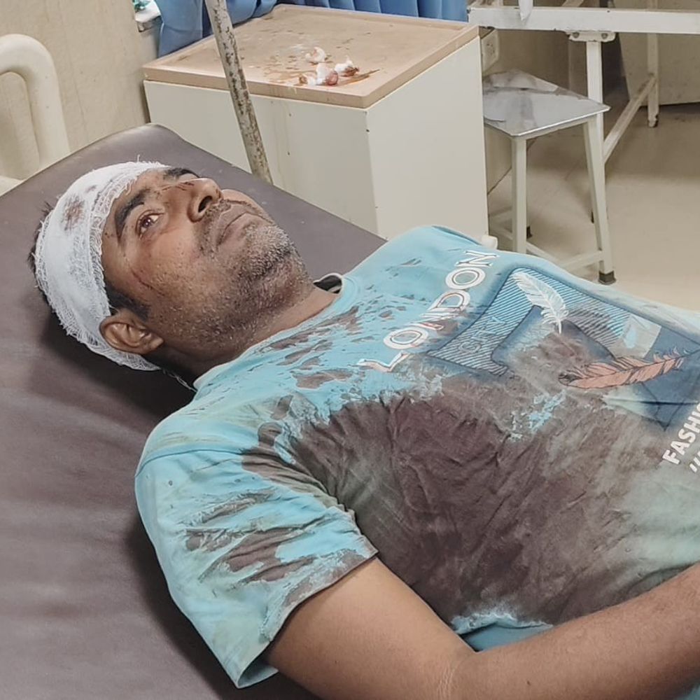 जमीनी विवाद में दो भाइयों पर हमला:बहराइच में लाठी-डंडों से मारपीट, हमलावर मौके से फरार