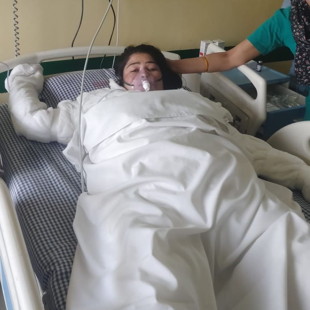 पीलीभीत में विवाहिता को देवर-देवरानी ने जलाया:डीजल छिड़ककर लगाई आग, पीड़िता की हालत गंभीर