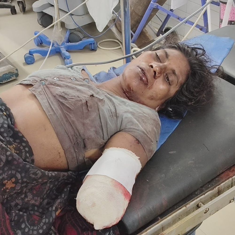 लकड़ी लेने गई महिला पर तेंदुए ने किया हमला:बायां हाथ बुरी तरह जख्मी, जिला अस्पताल में भर्ती