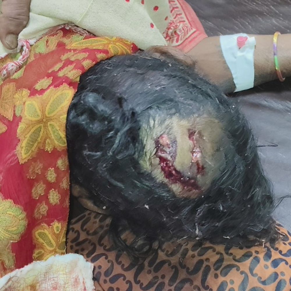 बहराइच में महिला पर बंदर का हमला:सिर में आई गंभीर चोट, जिला अस्पताल में चल रहा है इलाज