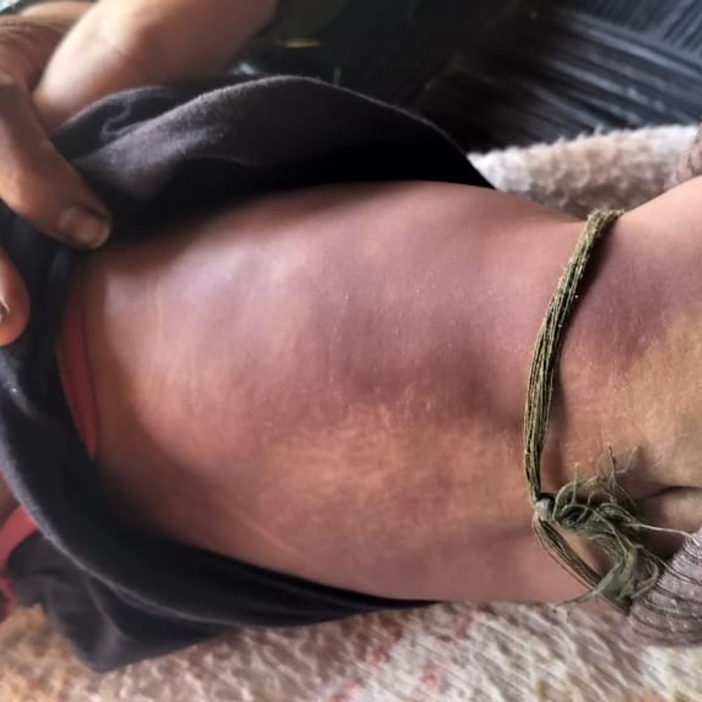 लखनऊ में 2-महीने के बच्चे की संदिग्ध हालत में मौत:परिजन बोले- टीकाकरण के बाद खराब हुई तबीयत, 4 दिन में दम तोड़ा