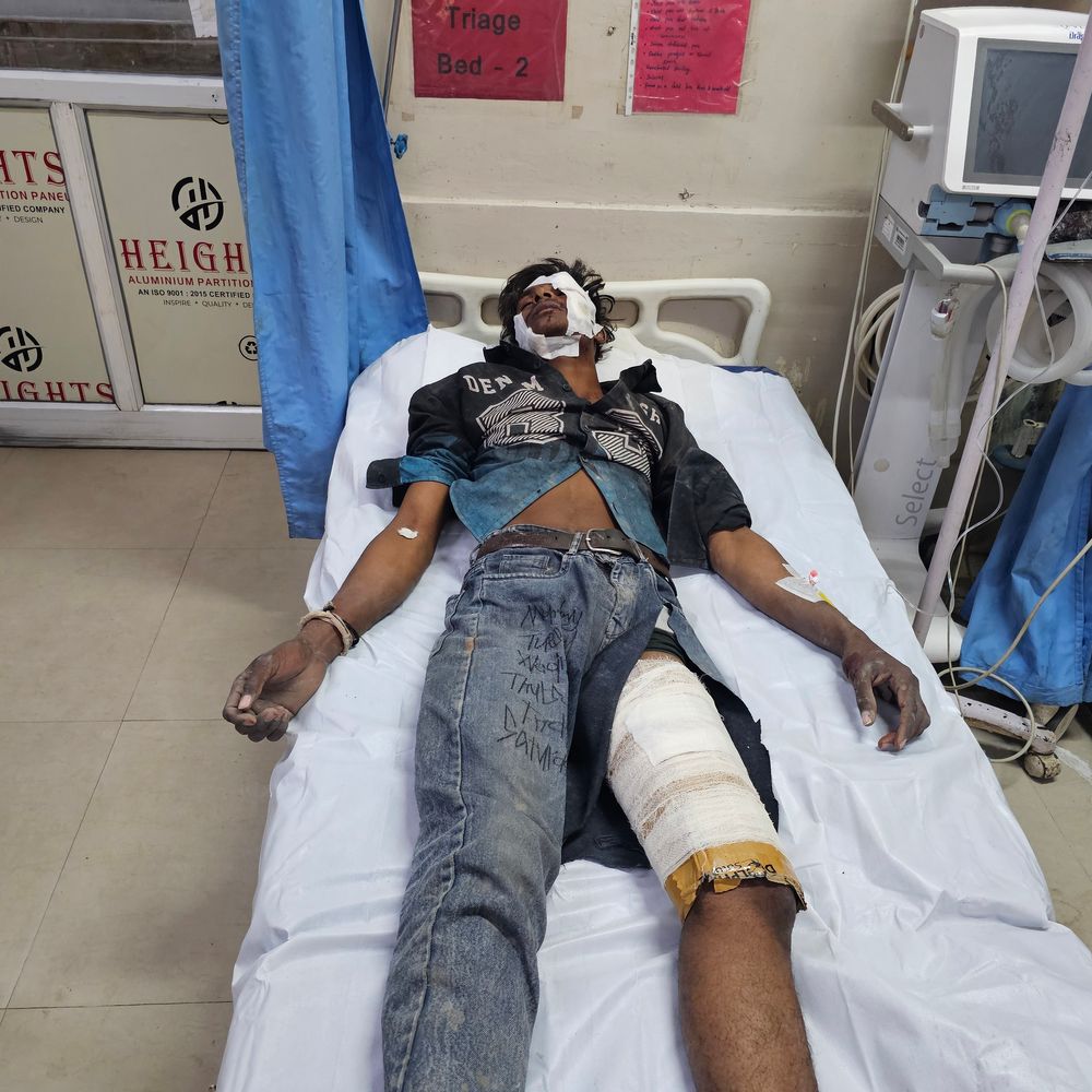 सीतामऊ में मजदूरी करते मिस्त्री दूसरी मंजिल से गिरा:  मंदसौर में मजदूर गंभीर घायल, अस्पताल में भर्ती; उच्च केंद्र रेफर की तैयारी – Mandsaur News