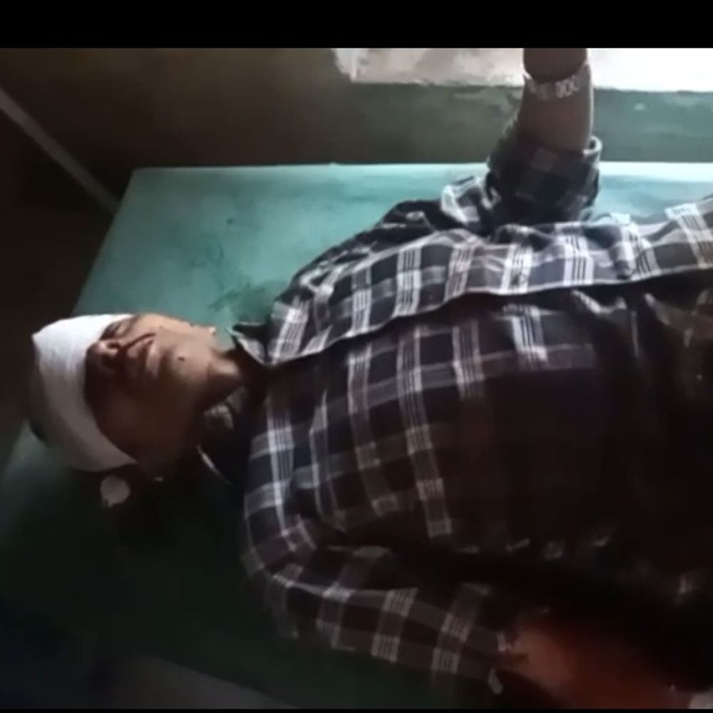 शिक्षामित्र पर कुल्हाड़ी से हमला, हालत गंभीर:बस्ती में सुबह स्कूल जाते समय किया वार, जिला अस्पताल रेफर