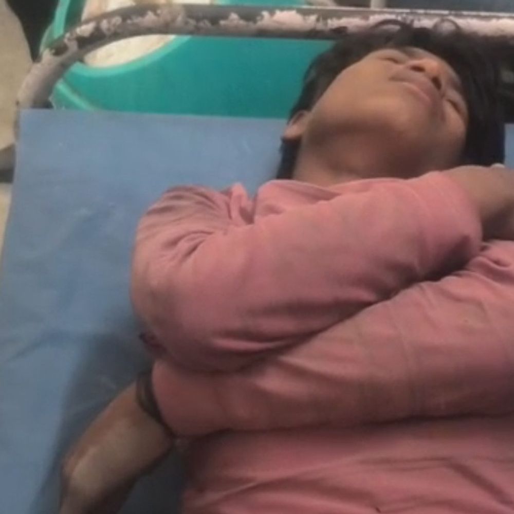 संभल में जंगली शूकरों का हमला, किशोर घायल:मक्का खेत में रखवाली करने गया था, पुलिस ने चलाया सर्च ऑपरेशन