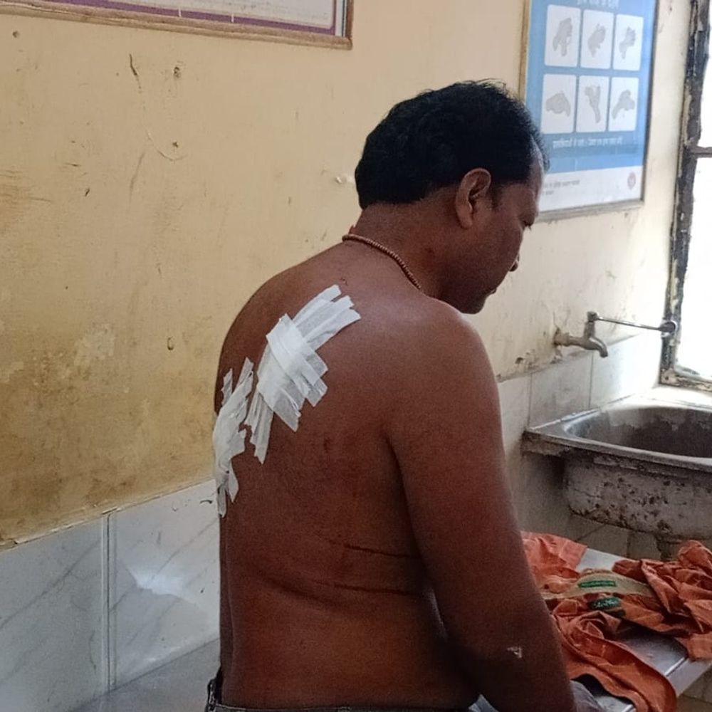 सुल्तानपुर में खतौनी जमीन विवाद पर हमला:धारदार हथियार से एक व्यक्ति घायल, FIR दर्ज, पुलिस जांच में जुटी