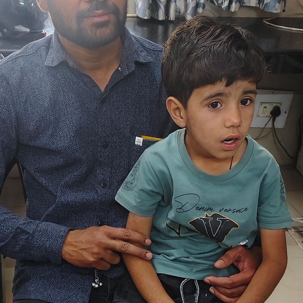 बागपत में बंदरों का हमला, बच्चा छत से गिरा:जिला अस्पताल में इलाज जारी