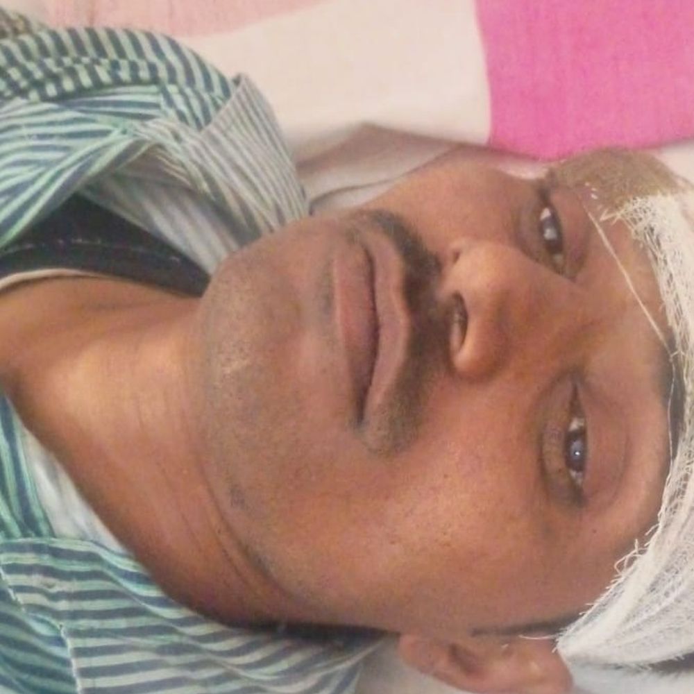 11 हजार वोल्ट लाइन से दो संविदा कर्मी झुलसे:देवरिया में ट्रांसफार्मर पर काम के दौरान हुआ हादसा, एक की हालत गंभीर