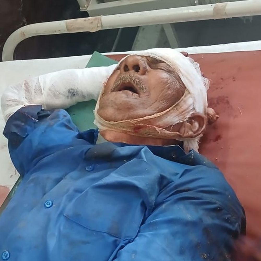 अयोध्या में गाड़ी की टक्कर से बुजुर्ग घायल:मंदिर दर्शन को निकले व्यक्ति को मेडिकल कॉलेज भेजा गया