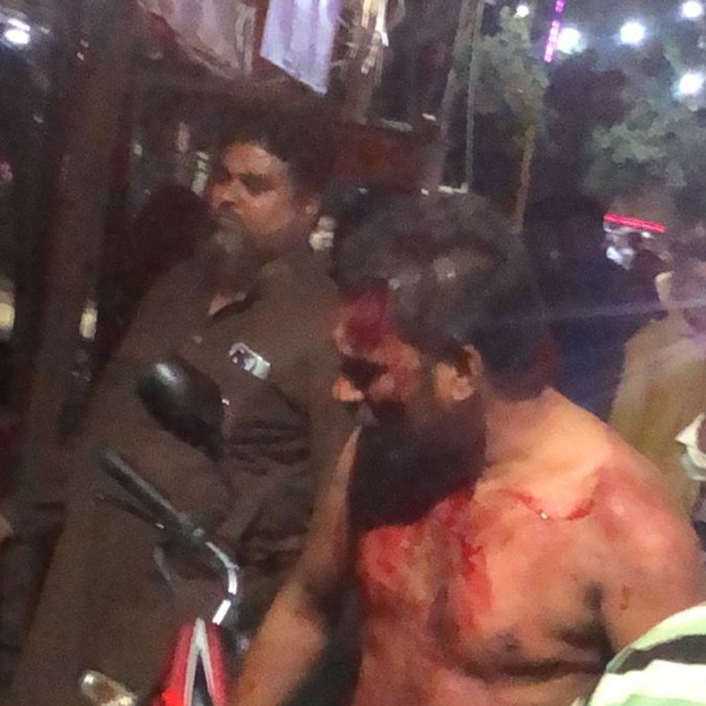 कादरीगेट चौराहा पर दुकानदारों में मारपीट:फर्रुखाबाद में ठेली लगाने को लेकर चले लाठी-डंडे, VIDEO आया सामने