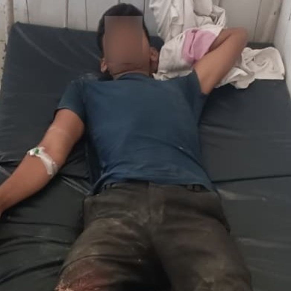 फिरोजाबाद में 25 हजार काइनामी बदमाश गिरफ्तार:पैर में लगी गोली, पुलिसकर्मियों को कुचलने का प्रयास करने वाला पकड़ा गया, सीसीटीवी आया था सामने