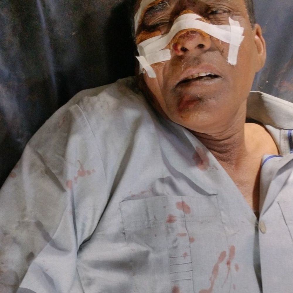 अज्ञात वाहन की टक्कर से बाइक सवार घायल:जानसठ में हादसा, सामुदायिक स्वास्थ्य केंद्र में भर्ती