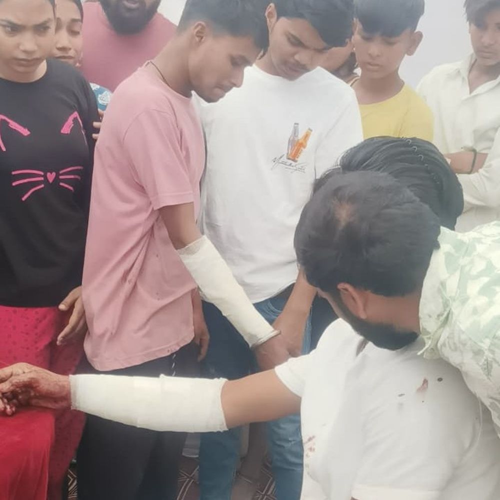 अंबेडकर प्रतिमा पर माल्यार्पण को लेकर बवाल:लखनऊ में दो पक्षों में मारपीट, हवाई फायरिंग; कई घायल