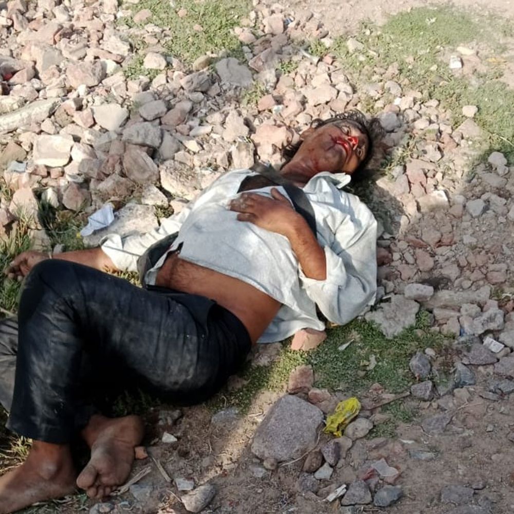 कल्याणपुर में अनियंत्रित लोडर ने खंभे-बाइक को टक्कर मारी:हादसे में लोडर ड्राइवर समेत तीन घायल, अस्पताल में भर्ती