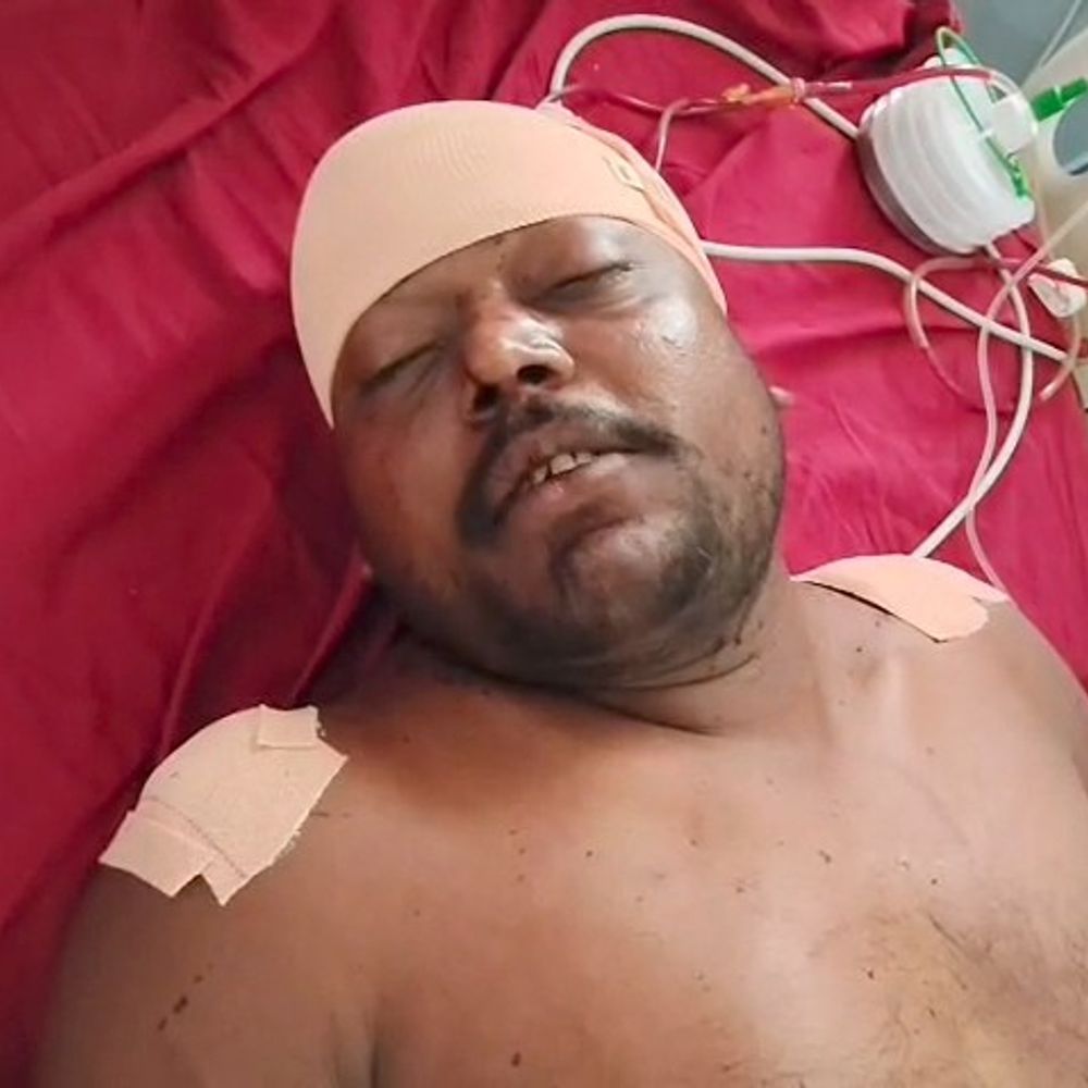 घर से उठाकर खेत ले गए, फिर मारी गोली:  लव मैरिज से नाराज लड़की के पिता ने लड़के के भाई पर किया हमला, एक गिरफ्तार – Begusarai News