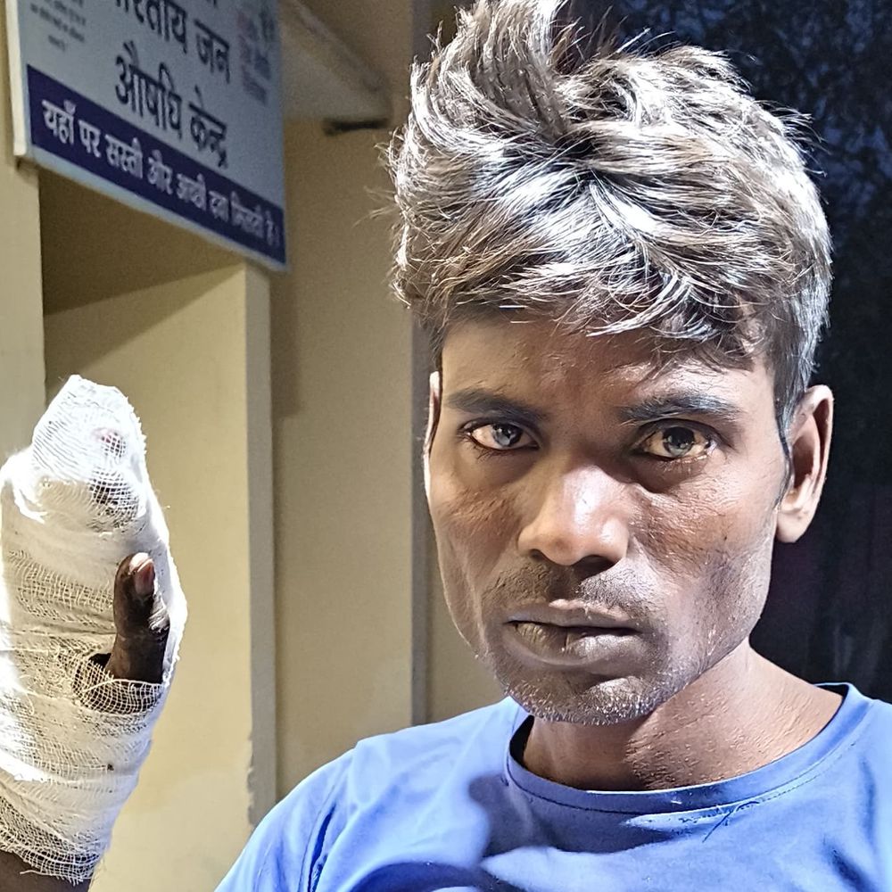 
                 थ्रेसर से युवक के दाहिने हाथ की चार उंगलियां कटीं:प्रतापगढ़ में मड़ाई के दौरान हुआ हादसा, मेडिकल कॉलेज रेफर 
            