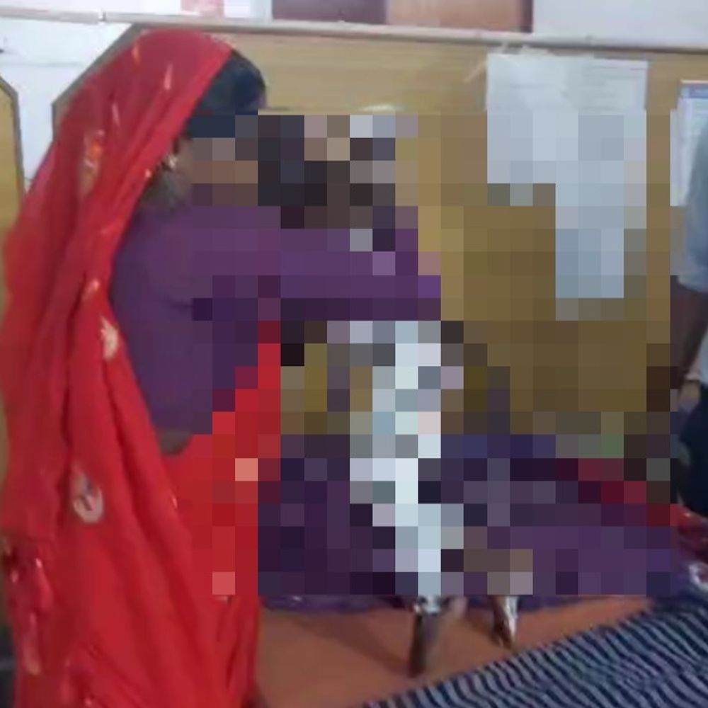 पीलीभीत में खौलती सब्जी की कड़ाही में गिरी मासूम:गंभीर हालत में जिला अस्पताल रेफर, घर के आंगन में खेल रही थी बच्ची