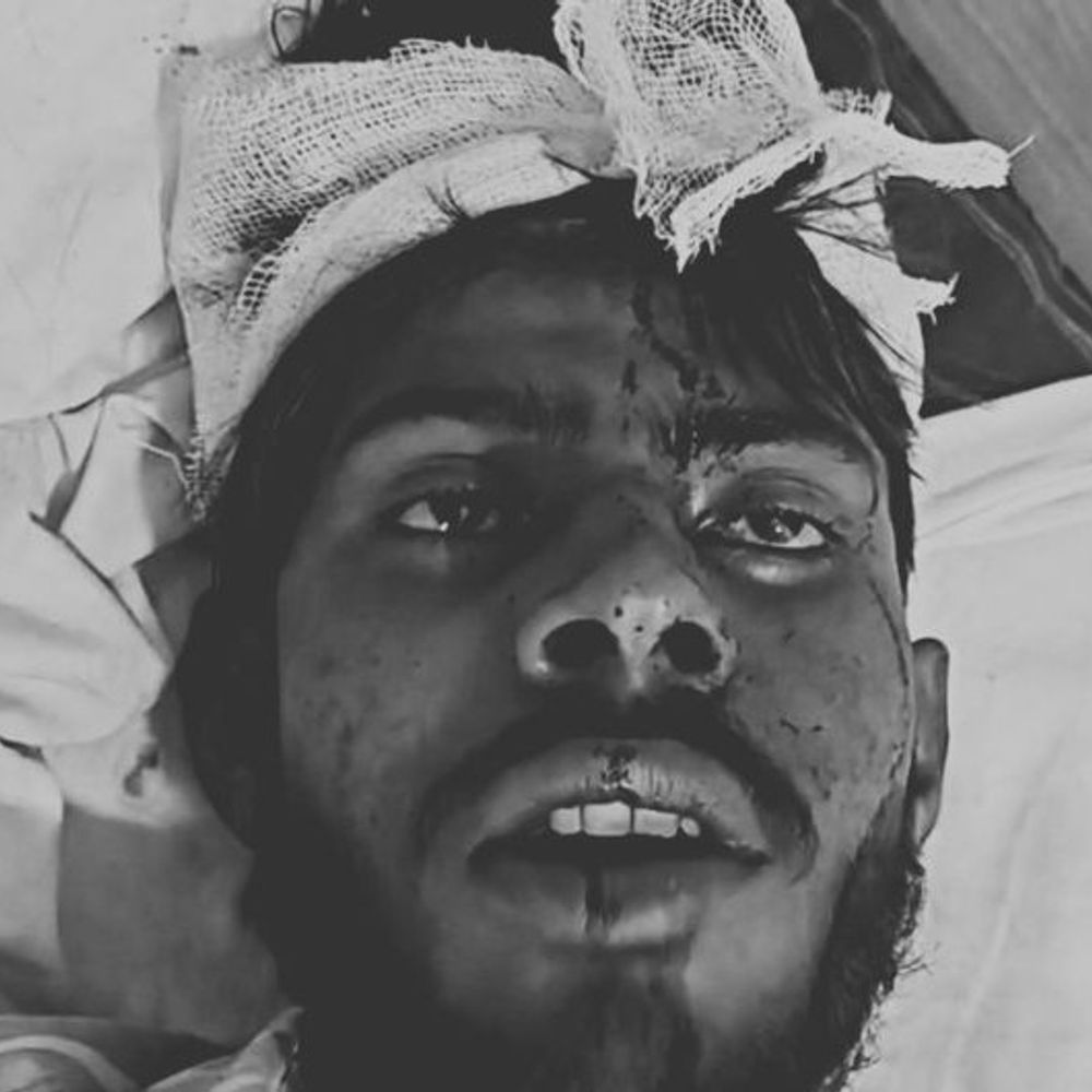 फिरोजाबाद में युवक ने ब्लेड से काटा खुद का गला:युवती के घर शादी से मना करने पर उठाया आत्मघाती कदम, हालत गंभीर