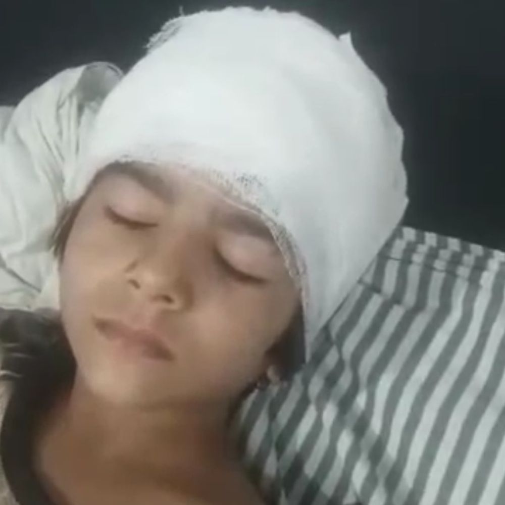 मेरठ में तेज रफ्तार कार से बच्ची को टक्कर:विरोध करने पर परिवार पर लाठी-डंडों से हमला, बच्ची गंभीर