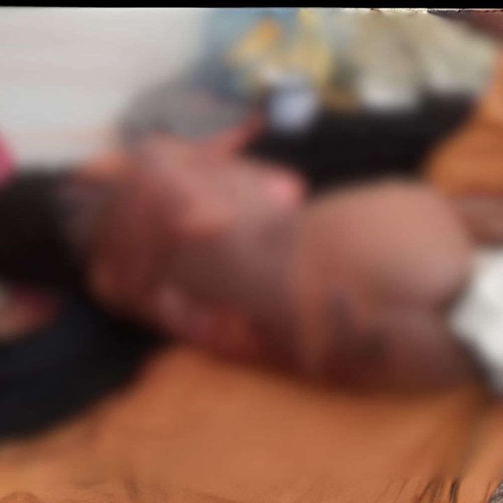 आग में जलकर 3 साल की मासूम की मौत:उन्नाव के सुदर्शन खेड़ा में अज्ञात कारणों से लगी आग, उपचार के दौरान तोड़ा दम