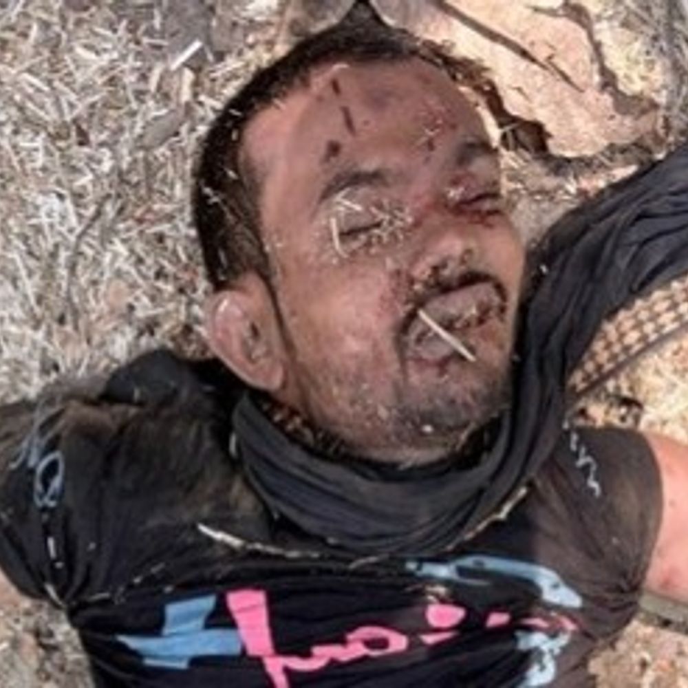 अयोध्या के कुशहरी जंगल में मिला अज्ञात युवक का शव:हत्या कर फेंकने की आशंका, शिनाख्त नहीं हो सकी, पुलिस पहचान में जुटी