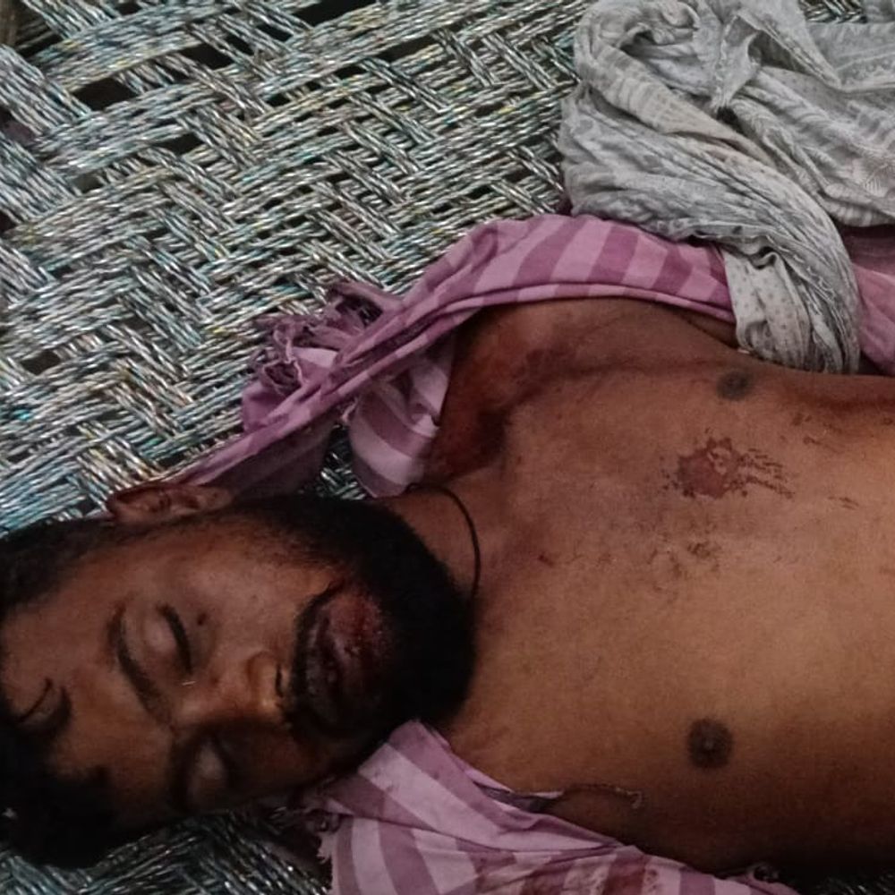 शामली में आकाशीय बिजली गिरी:गेहूं कटाई के दौरान युवक की मौत, तीन लोग गंभीर घायल