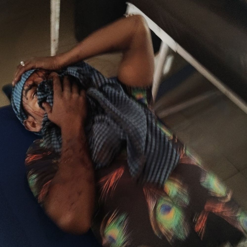 हाथरस में डंपर ने ऑटो में मारी टक्कर:ऑटो में सवार 10 लोग घायल, जिला अस्पताल में भर्ती