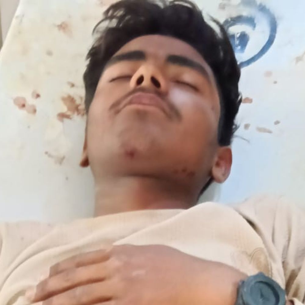 डंपर का टायर फटा, 3 बाइक सवार घायल:एक युवक टायर के नीचे दबा, कानपुर रेफर; दो जिला अस्पताल में भर्ती