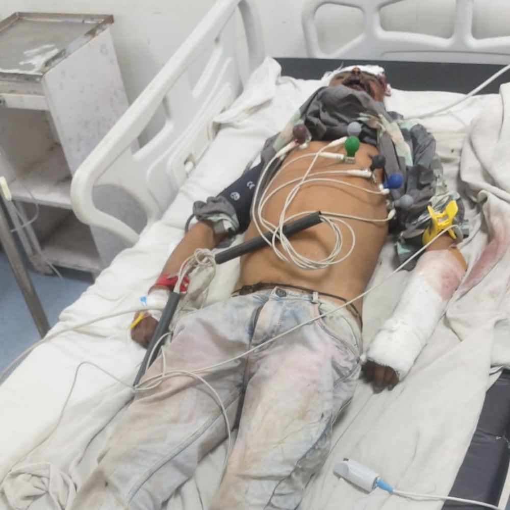अज्ञात व्यक्ति की ICU में इलाज के दौरान मौत:पुलिस ने पहचान के लिए मोबाइल नंबर जारी किया
