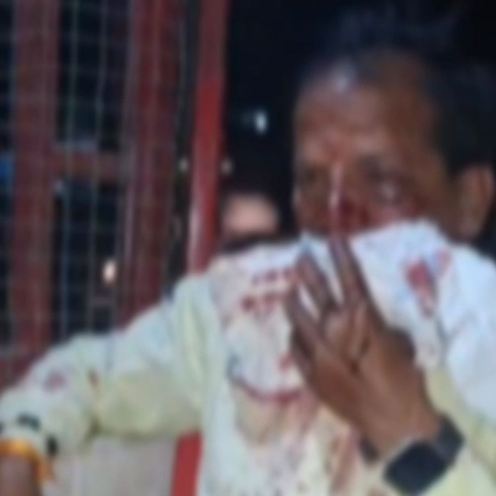 गोंडा में बुजुर्ग पर लाठी-डंडे और चाकू से हमला:रास्ते में घात लगाकर कर रहे थे इंतजार, जबड़ा टूटा, आरोपी फरार