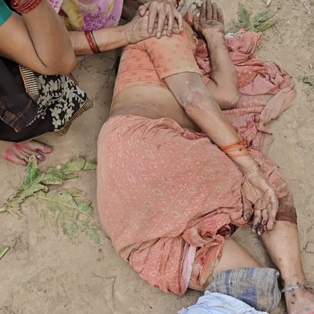 बस्ती में जमीन विवाद में खूनी संघर्ष, दो गंभीर घायल:एक ही परिवार के पांच लोगों पर धारदार हथियार से हमला, मुकदमा दर्ज