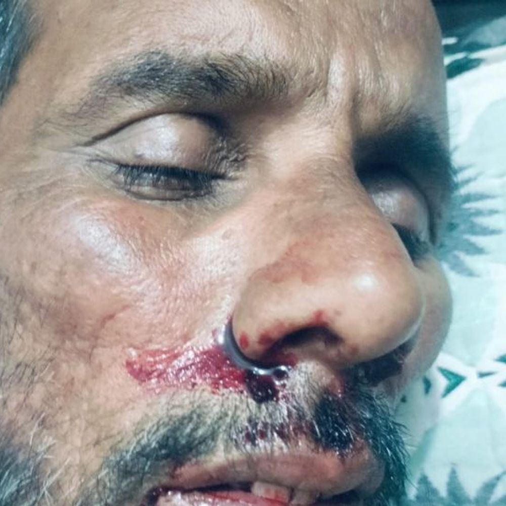 सहारनपुर में युवक को उठाकर टॉर्चर किया:पत्नी बोली-घर से जबरन उठाकर पूरी रात पीटा, मारपीट कर वसूले 80 हजार रुपए