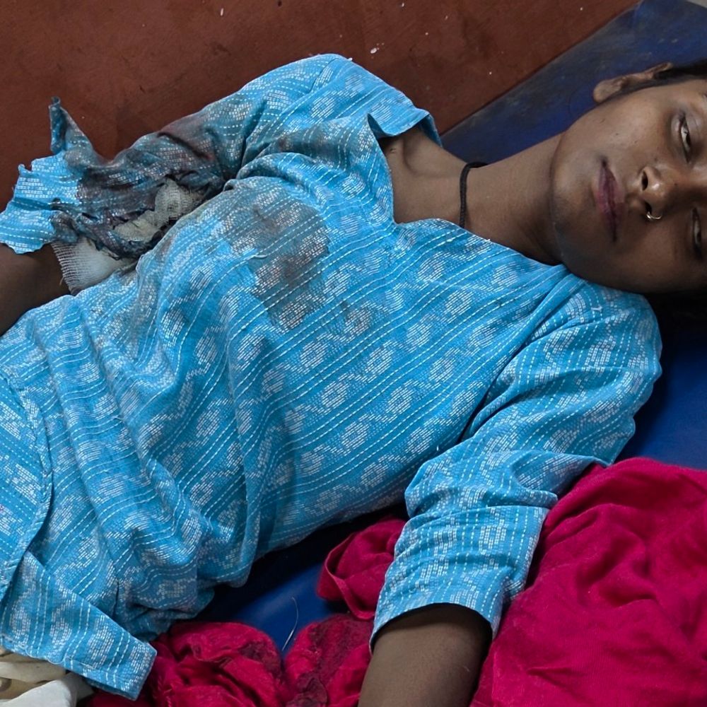 रुपए मांगने पर जेठ ने बहू को गोली मारी:हरदोई पुलिस पर लापरवाही का आरोप, घायल महिला मेडिकल कॉलेज में भर्ती