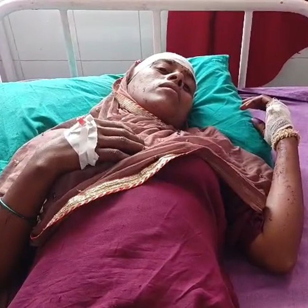 सीतापुर में रास्ते विवाद में चले लाठी-डंडे और धारदार हथियार:महिलाओं समेत 5 लोग घायल, 3 जिला अस्पताल रेफर; जांच जारी