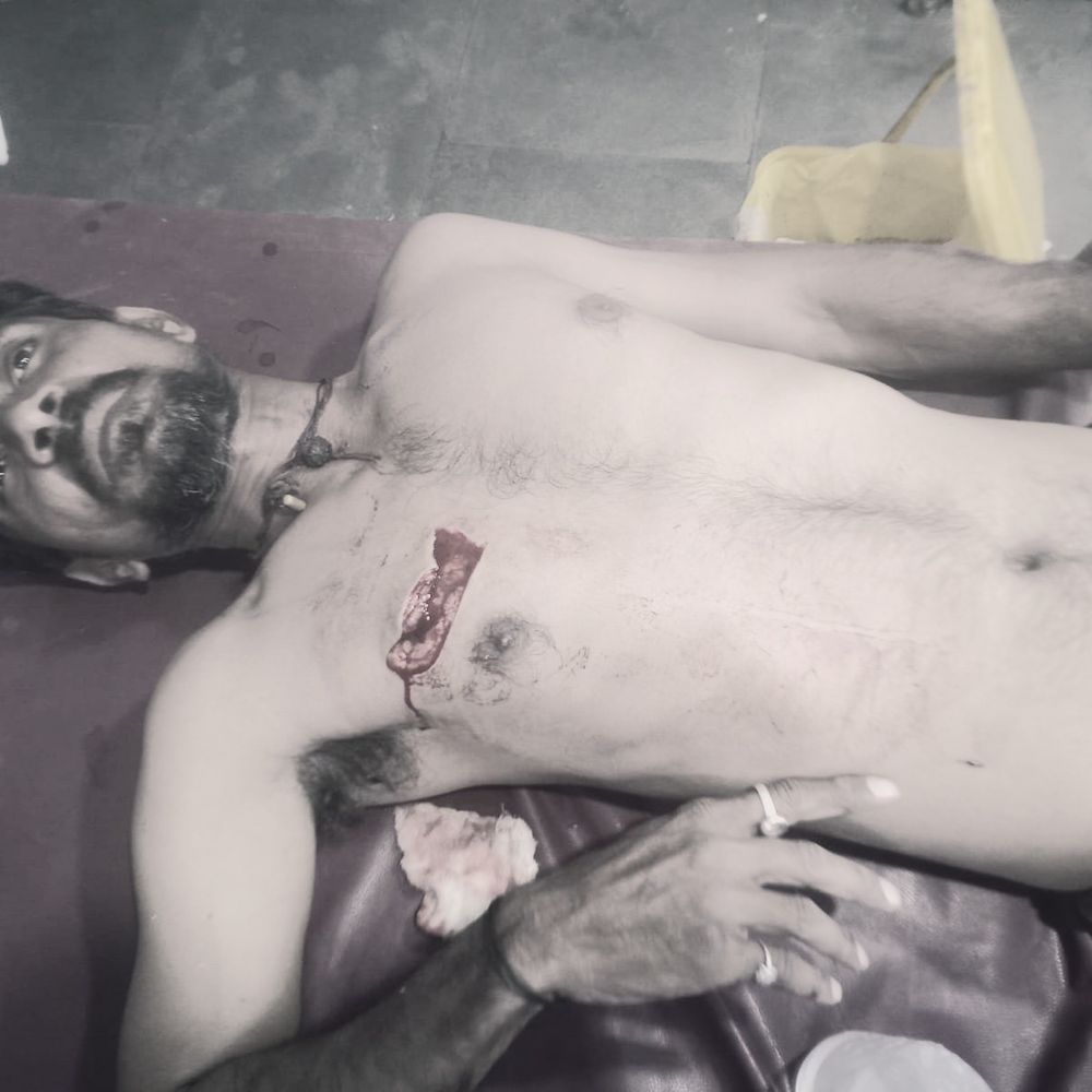 शिवगंज में चाकूबाजी, युवक गंभीर घायल:  मुंह पर रुमाल बांधकर आया आरोपी, पुलिस तलाश में जुटी – Sirohi News