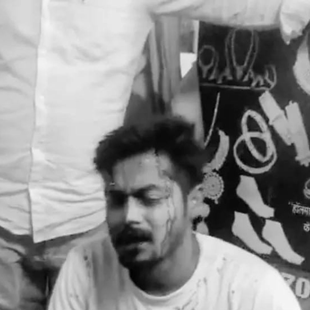 बस्ती में व्यापारी को गोली मारी, हाथ में लगी:दुकान से घर जाते समय बाइक सवार बदमाशों ने रोका, सिर पर असहले की बट मारी