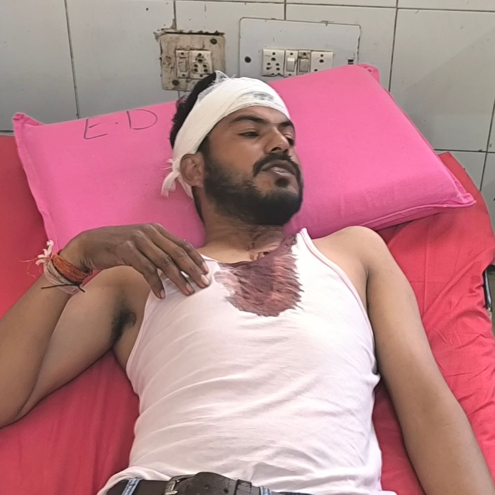 रास्ते के विवाद में युवक की पिटाई, अस्पताल में भर्ती:मैनपुरी में विकास भवन के सामने निर्माण को लेकर झगड़ा, जांच शुरू