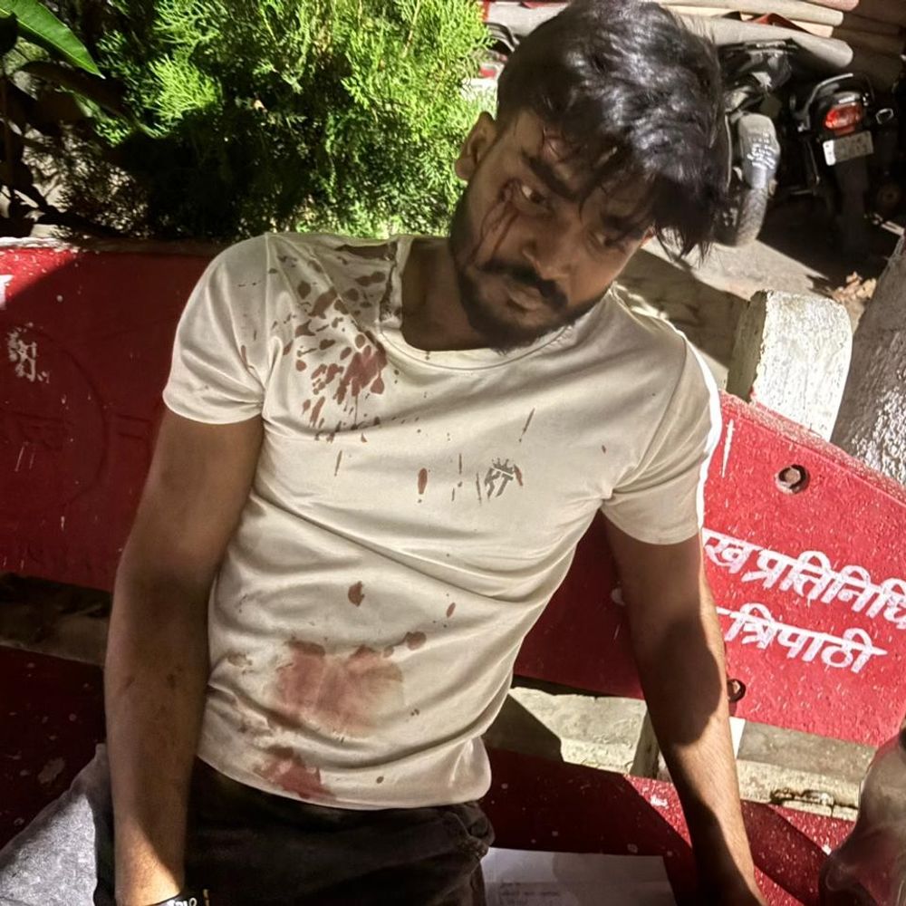 निषाद पार्टी युवामोर्चा जिलाध्यक्ष पर हमला:6 नामजद और सात अज्ञात पर मुकदमा दर्ज, न्याय की मांग