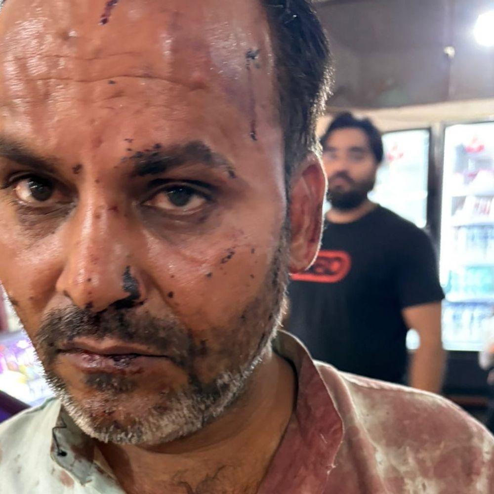 फिरोजाबाद में होटल में युवकों ने कर्मचारी का सिर फोड़ा:नशे में धुत युवकों पर लूट और तोड़फोड़ का आरोप