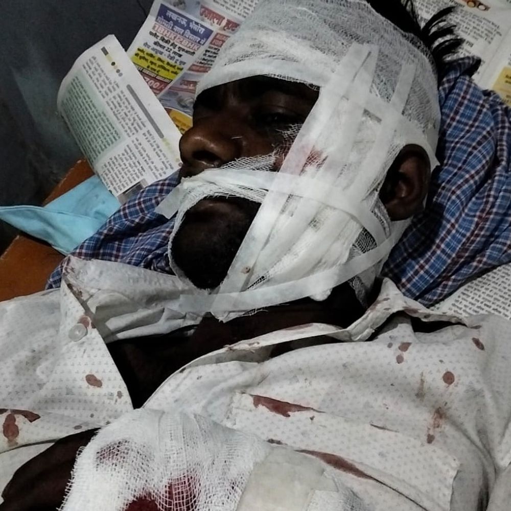 सीतापुर फायरिंग कांड का खुलासा, दो आरोपी गिरफ्तार:जमीन विवाद में सोते पिता-पुत्र पर की थी फायरिंग,जमीन बंटवारे को लेकर विवाद