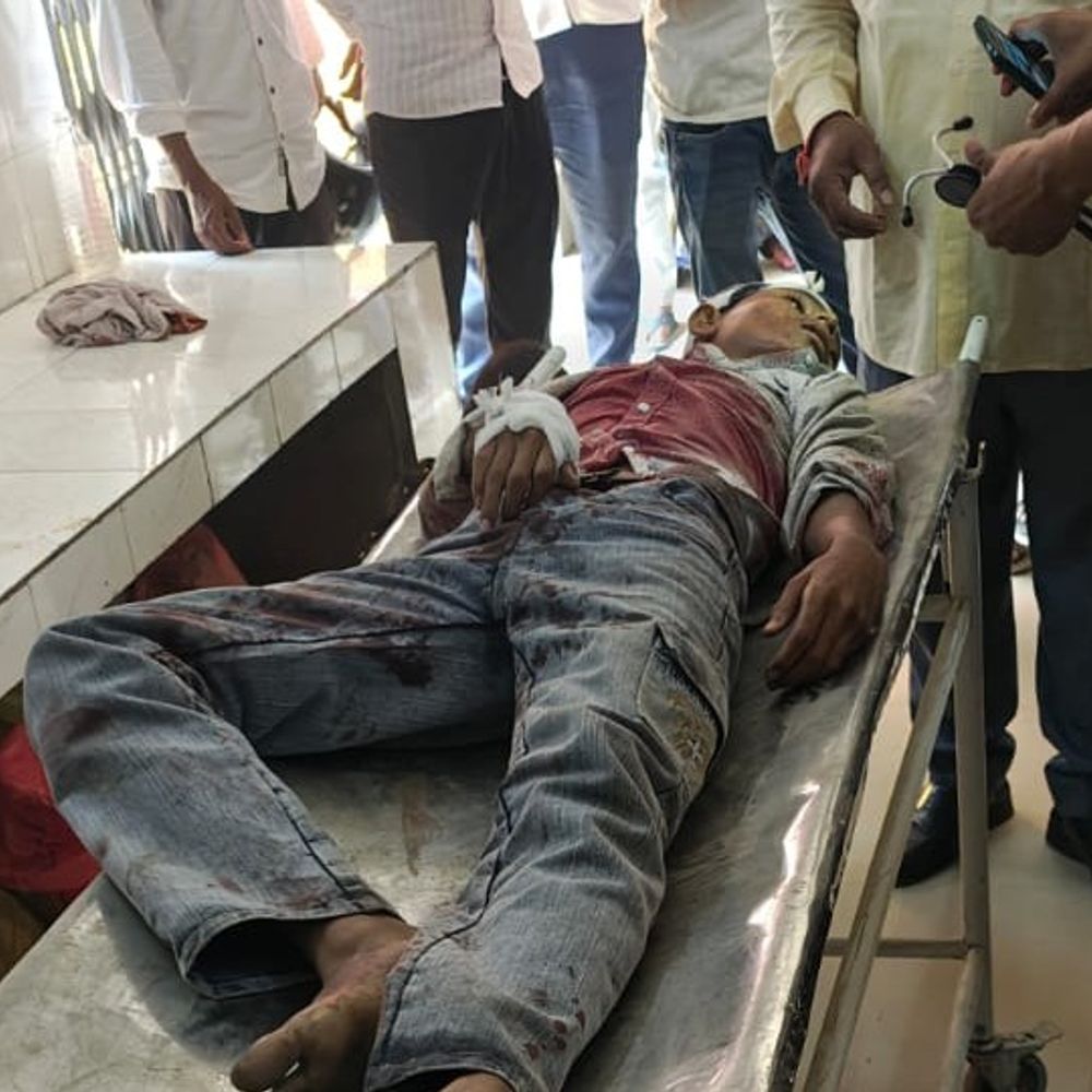 जूता पहनने पर भाई पर कैंची से किया हमला, मौत:ऑनलाइन मंगाए गए जूते को पहले पहनने को लेकर हुआ था विवाद