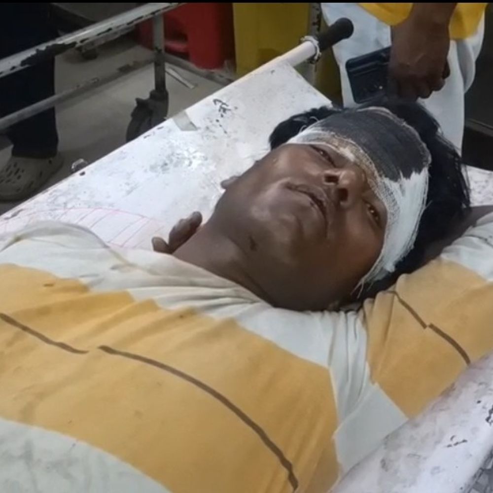 जूस के पैसे मांगने पर पिता-पुत्र पर हमला:दबंगों ने लाठी-डंडों से पीटा, जिला अस्पताल में चल रहा दोनों का इलाज