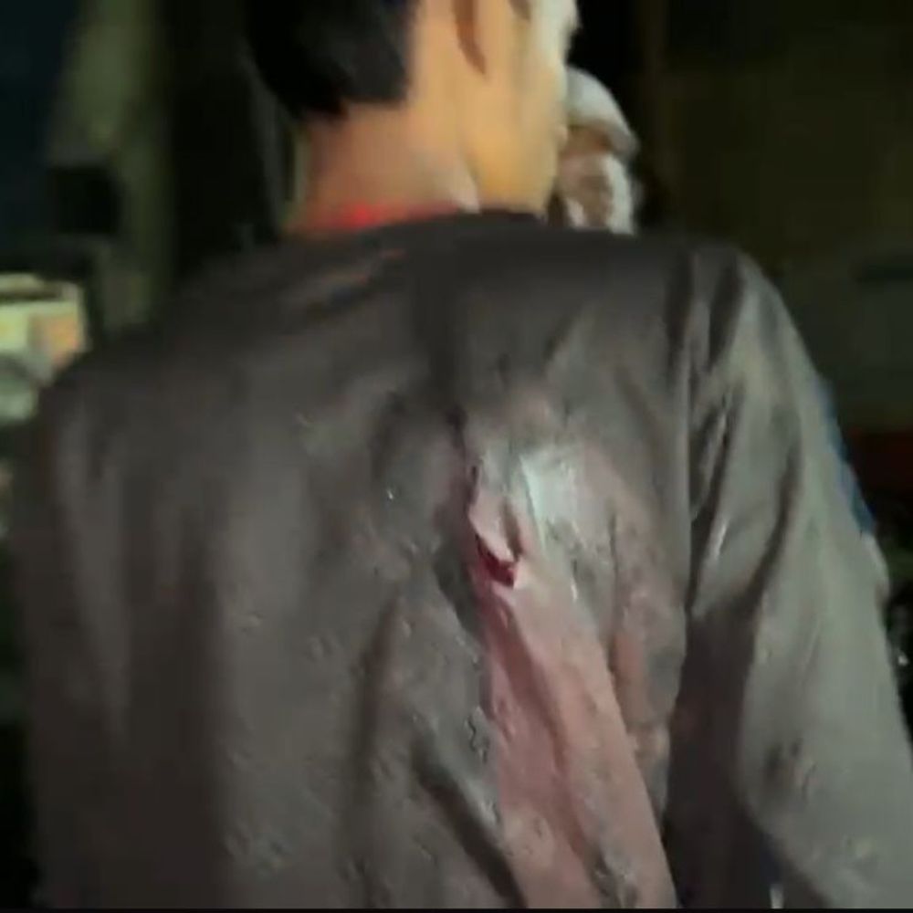 जमशेदपुर में दो नाबालिगों पर चापड़ से हमला:  दोनों घायल, बिरसानगर धोबी मोड़ पर हुई घटना; आपसी विवाद में वारदात की आशंका – Jamshedpur (East Singhbhum) News