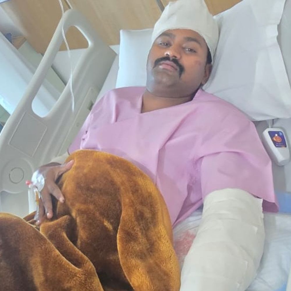 हादसे में घायल दरोगा की हालत में सुधार:कमर में चोट, कुछ दिन अस्पताल में रहेंगे; दूसरे दिन भी आरोपी चालक फरार