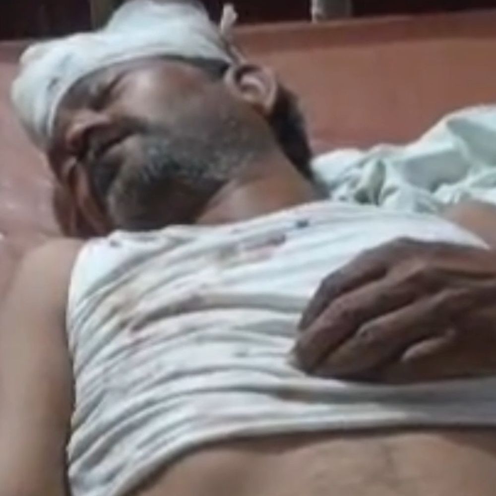 कल्याणपुर में बर्फ काटने के सूजे से युवक पर हमला:गंभीर हालत में हैलट ICU में भर्ती, पुलिस आरोपियों को ढूंढ रही