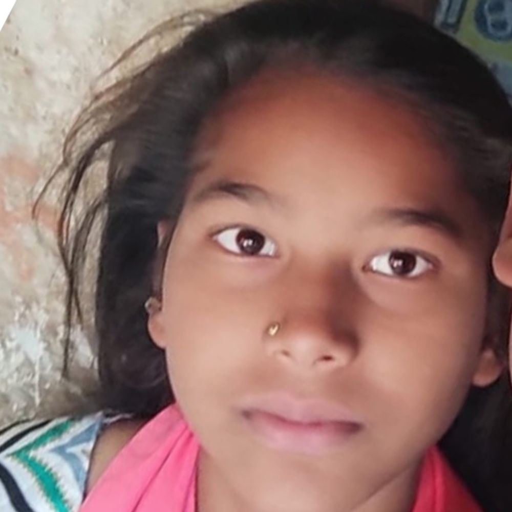 चंदौसी में बुखार से पीड़ित किशोरी की मौत:परिजनों ने इलाज में लापरवाही का आरोप लगाया, पुलिस ने शांत कराया