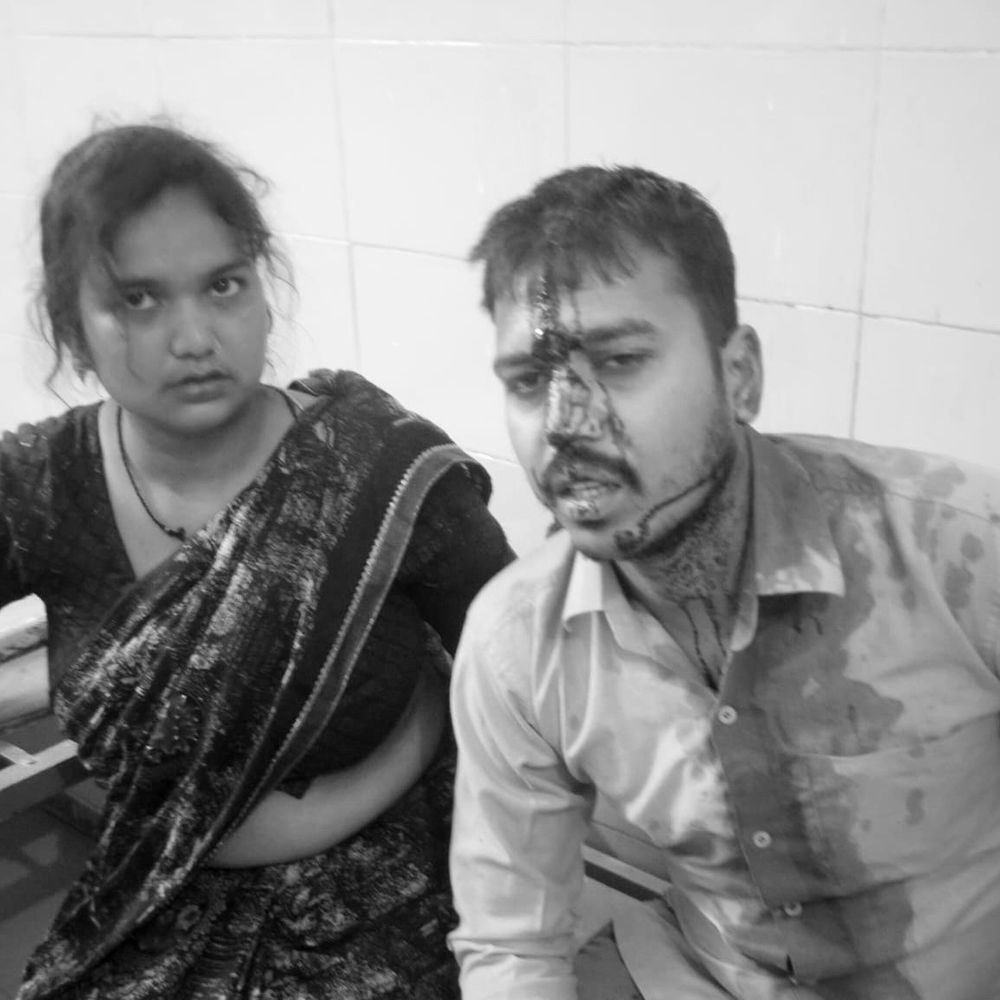 एटा: पति-पत्नी विवाद सुलझाने गए मायके वालों पर हमला:दामाद और परिजनों ने लाठी-डंडों, फावड़े से पीटा, दो घायल