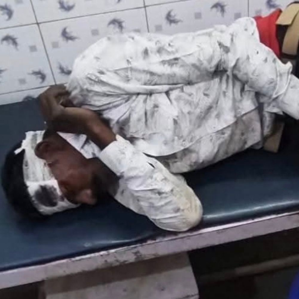 जसवंतनगर सड़क हादसे में एक की मौत, तीन घायल:कचौरा बाईपास पर अज्ञात वाहन ने मारी टक्कर, घायलों को सीएचसी में इलाज जारी