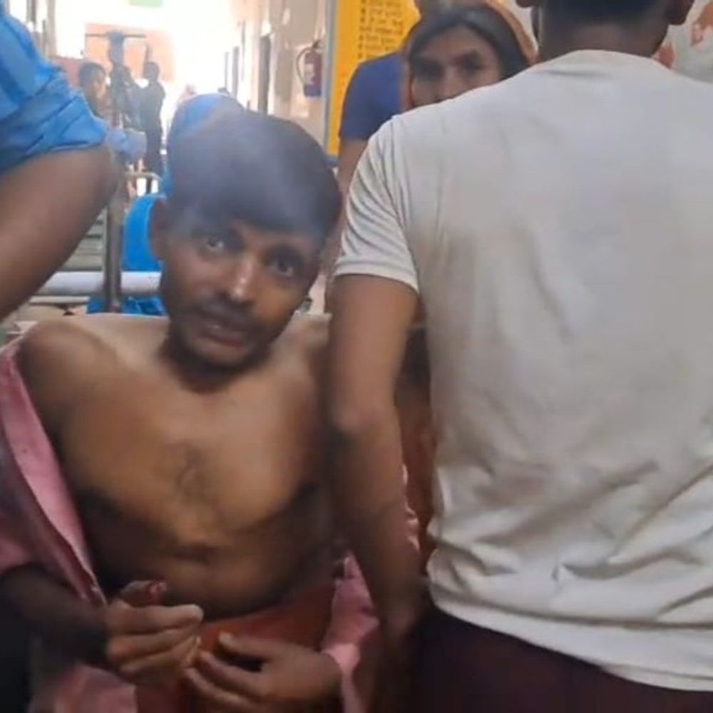 आवारा कुत्ते ने 100 से अधिक लोगों को काटा:बदायूं में बरातियों और ग्रामीणों पर हमला, किसान ने फावड़े से मारा